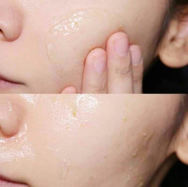 MẶT NẠ CẤP NƯỚC