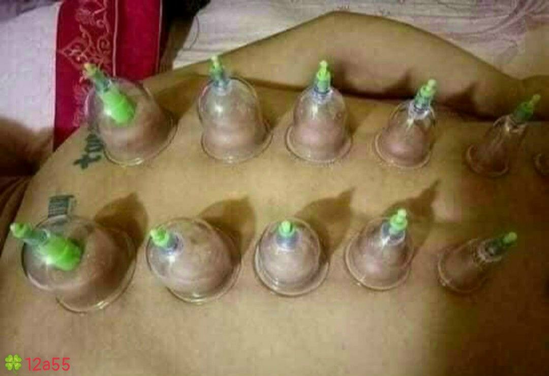 BỘ GIÁC HƠI 12 ỐNG KHÔNG DÙNG LỬA 