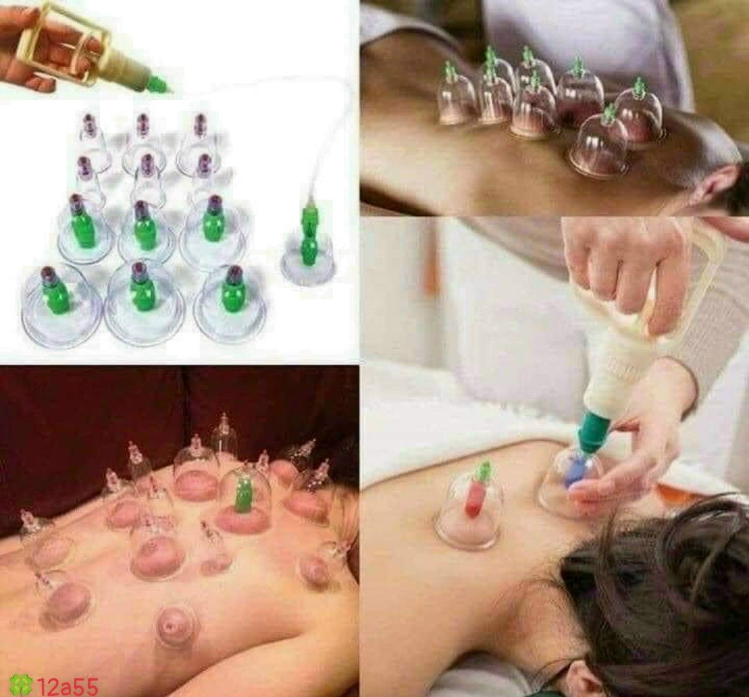 BỘ GIÁC HƠI 12 ỐNG KHÔNG DÙNG LỬA 