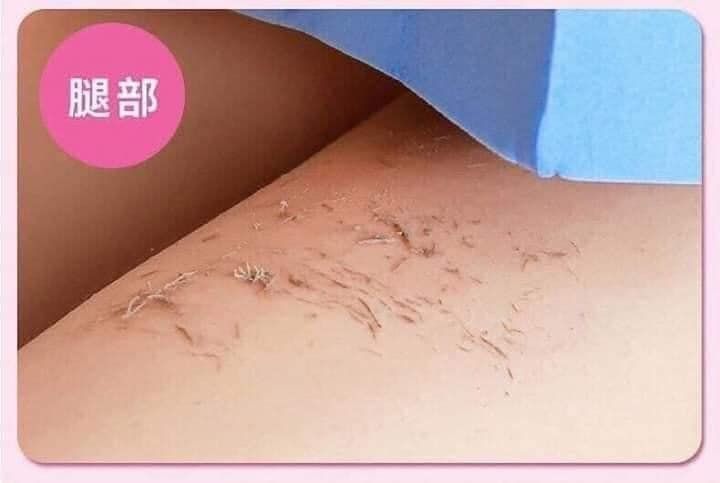  MIẾNG TẨY TẾ BÀO CHẾT -  BÁN TỪ 2 MIẾNG