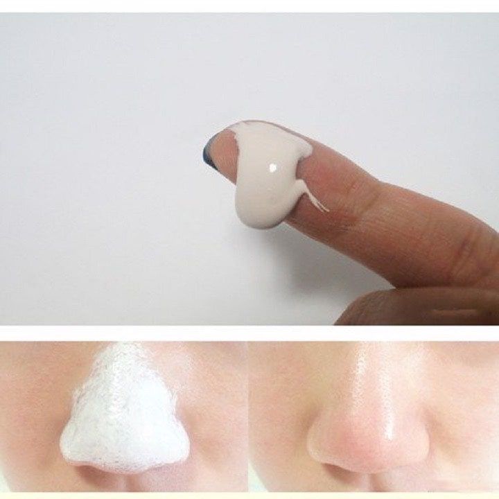 KEO LỘT MỤN ĐẦU ĐEN HANDMADE - Bán Từ 2 Tuýp